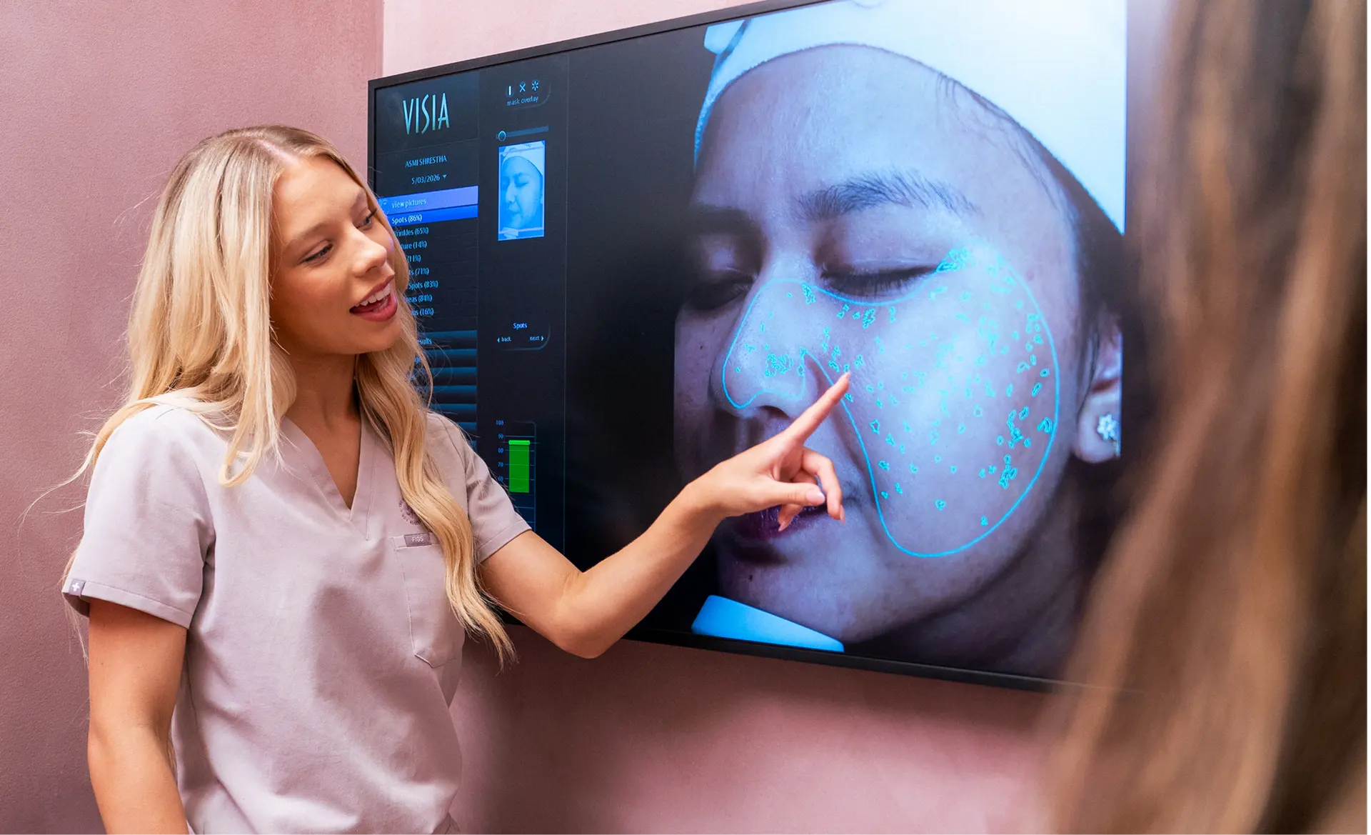 A practitioner guiding an AviClear handpiece across a client's cheek